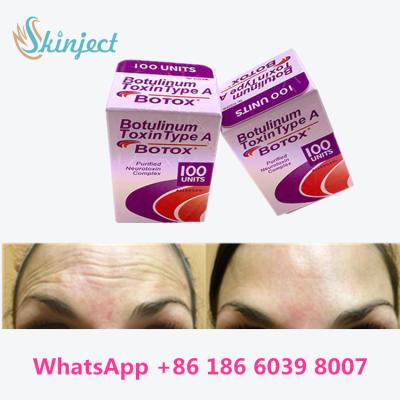 China allergan botulinum toxin Anti Aging Products Type A Toxin Anti Wrinkle for sale