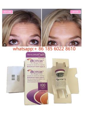 China Allergan  Botulinum Toxin 100IU Anti-Wrinkles for sale