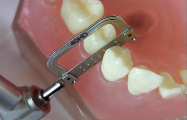 Dental orthodontic blade size comparison