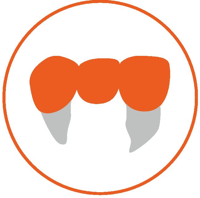 Anterior Bridge(3 units)