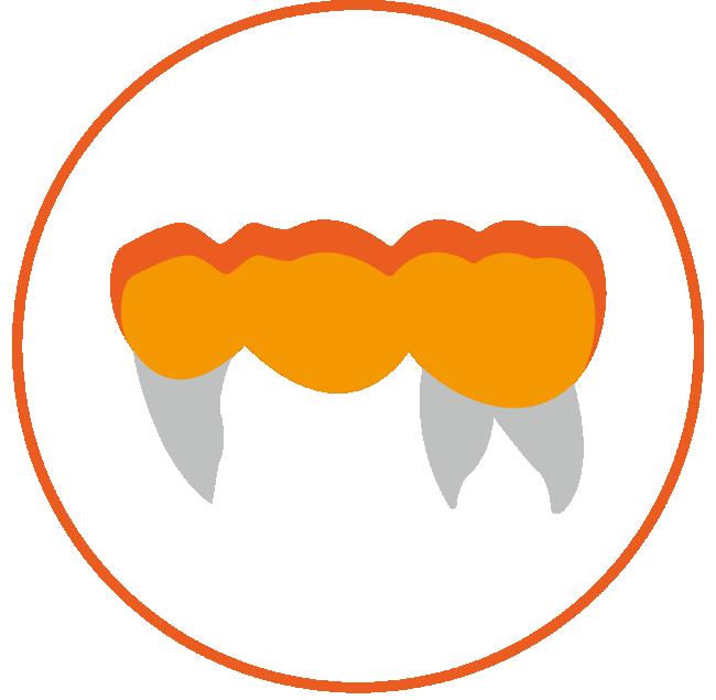 Reduced Posterior Bridge (3 units)