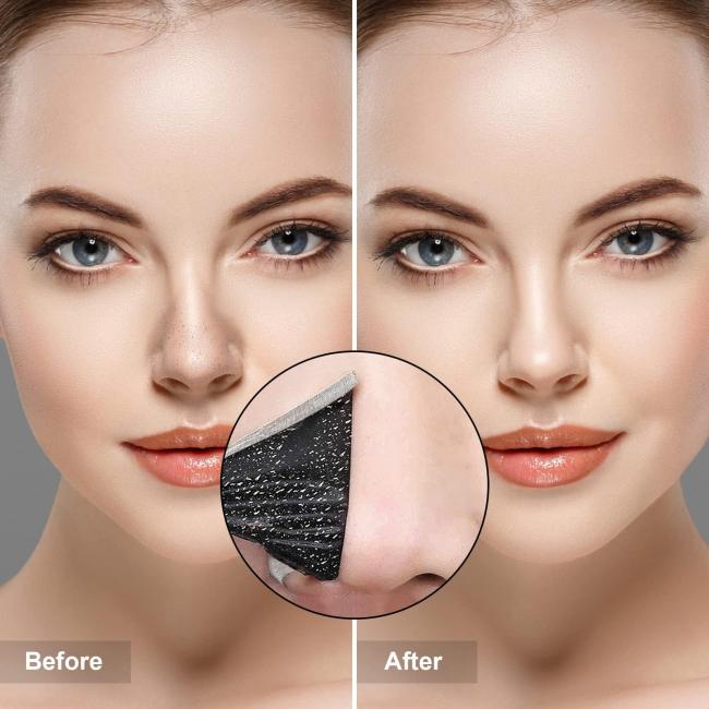 Customized Blue Heart Design Charcoal Nose Strips for Blackhead Removal Skin Cleanliness 1