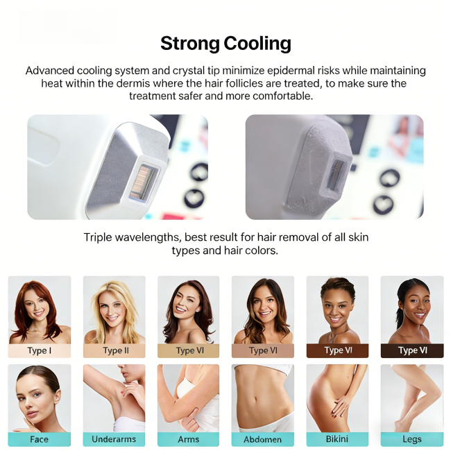 Professional Diode Laser Hair Removal Machine 755 808 1064nm | 100 Million Shots System 1