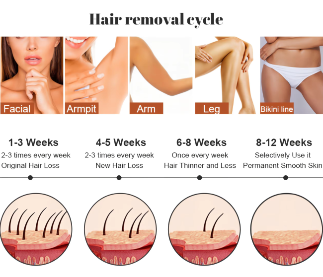 Professional Diode Laser Hair Removal Machine 755 808 1064nm | 100 Million Shots System 7
