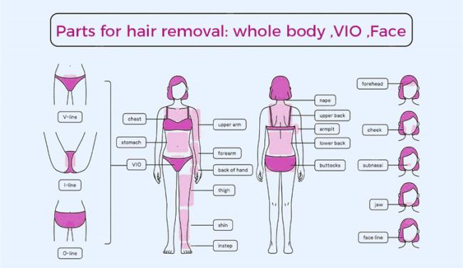 Advanced 755nm 808nm 1064nm Diode Laser System for Permanent Hair Removal Treatments 2