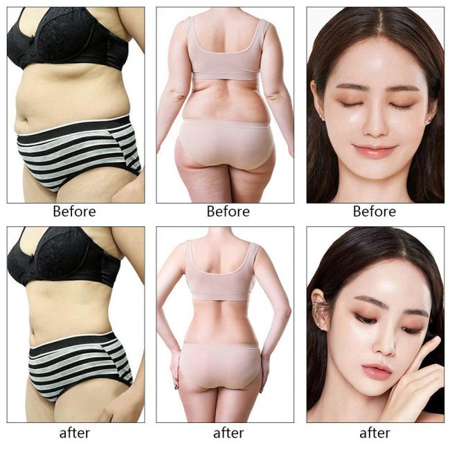 Professional 9 in 1 Cavitation RF Slimming Machine Ultrasonic Fat Reduction Body Contouring Device 4
