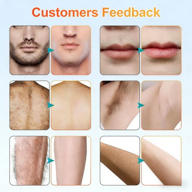 Professional Diode Laser Hair Removal Machine âââ‰â¬Å Triple Wavelength 755/808/1064nm for Med Spa 5