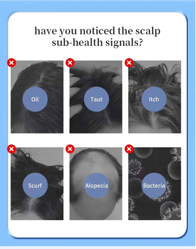 Advanced Scalp Care Machine with Hair Follicle Detection and Multi-Function Treatment for Salons 1
