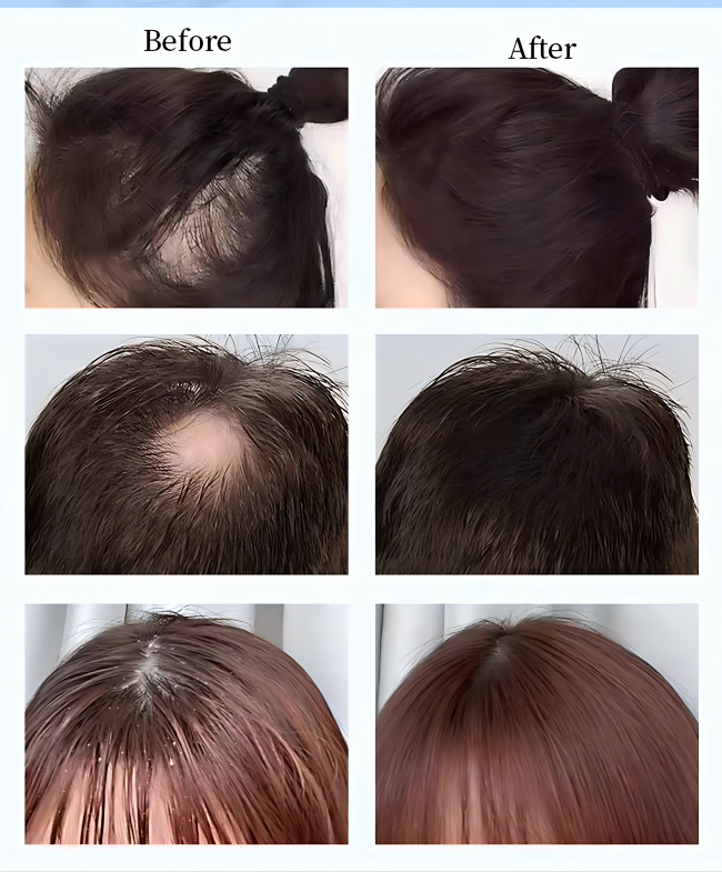 Advanced Scalp Care Machine with Hair Follicle Detection and Multi-Function Treatment for Salons 3