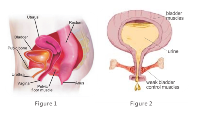 XFT-2002 Pelvic Muscle Exerciser device overview