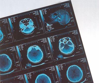 China Termal seca médica de la película de X Ray de Digitaces para el CR/dr del hospital en venta