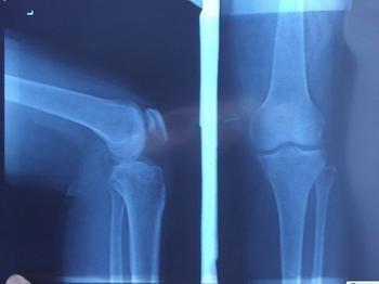China Blaue Diagnosedarstellung X Ray, medizinischer Laser-Papier-Röntgenstrahl-fotografischer Film zu verkaufen