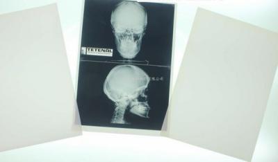 China Konida 10in X 12in X Ray Medical Imaging for sale