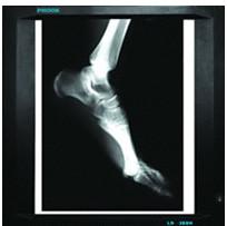 China 20cm x 25cm Medical Diagnostic Imaging , Laser Printer Film X Ray Paper for sale