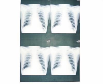 China White Base Medical X Ray Paper Film Moistureproof For Sony / EPSON Laser Printer for sale