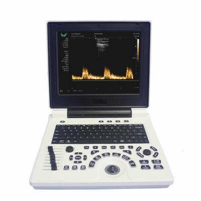 China ISO Electron Scan Notebook USG Scan Machine For Obstetrics And Gynecology for sale