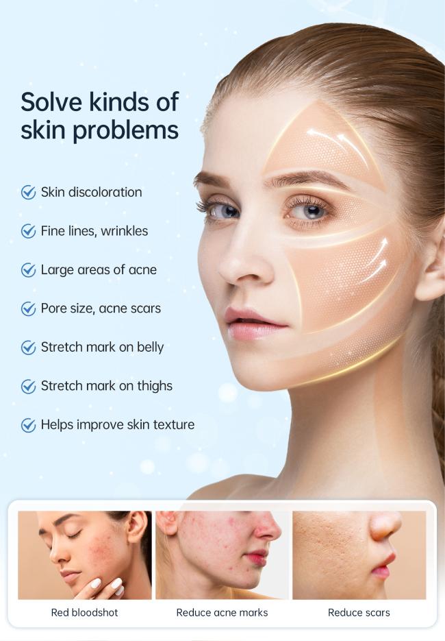 Liquid-carrying electric micro needle pen solving kinds of skin problem 8