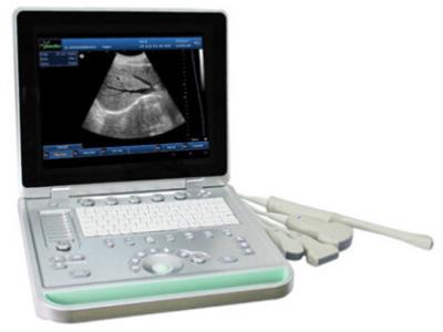 China 3D Digital Laptop Portable Ultrasound Scanner With All Kinds of Probe for sale