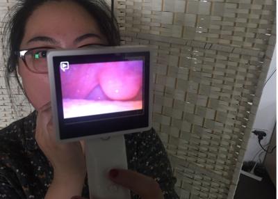 China Cámara video del laringoscopio de Rhinoscope del otoscopio de Digitaces de la tarjeta flash micro del SD para la garganta de la nariz del oído en venta