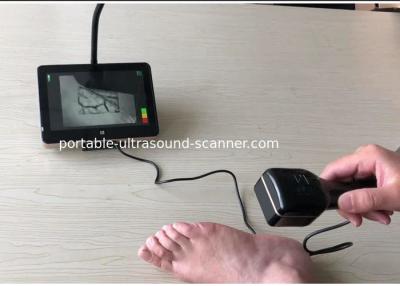 中国 医学の静脈の観覧システム赤外線静脈のロケータの LED ライトが付いている手持ち型の小型の静脈の視聴者 販売のため