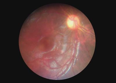 China Endoscopio video de Dermatoscope Digital del otoscopio del equipo óptico de la cámara oftálmica de la garganta con 2 millones de pixeles en venta