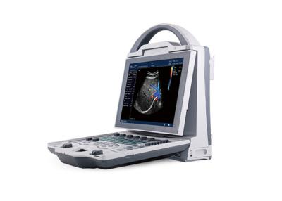 China Full Digital Color Doppler Machine Ultrasound Scanner With 10.4 Inch Angle Adjustable Monitor for sale