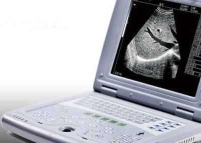 China Máquina portátil del ultrasonido para el peso portátil 2.2kgs del escáner del ultrasonido del embarazo solamente en venta