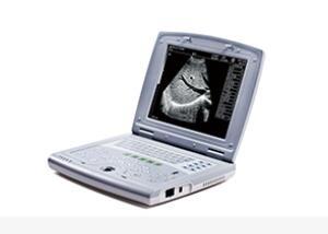 China Varredor portátil do ultrassom da máquina portátil do ultrassom do bebê para a pediatria à venda
