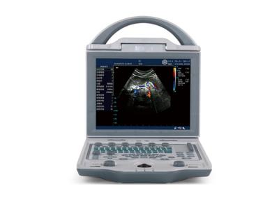 Chine Scanner portatif d'ultrason de machine portative d'échocardiographie avec le moniteur réglable de 10,4 pouces à vendre