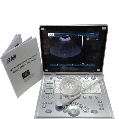 China Laptop Black And White Portable Ultrasound Scanner With 2 Probe Connector And 3D Optional for sale
