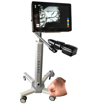 China Profundidad portátil médica de la proyección de imagen de la máquina del retiro de la vena de la araña del dispositivo del localizador de la vena < 10m m en venta