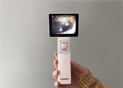 China Proyección de imagen general y Dermatoscope del otoscopio video de Digitaces de la cámara del oído del micro tarjeta SD USB en venta