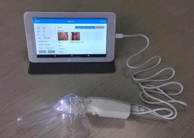 China Digital Video Colposcope for Woman Care 10 or 7 Inch Medical Monitor Professional Camera for Inspection of Cervix for sale