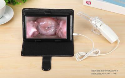 Cina Display ad alta definizione AV / USB uscita digitale sonda vaginale elettronico colposcopio in vendita