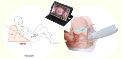 Chine Le Colposcope électronique endoscopique gynécologique de Digital de produit de soins de santé pour des femmes autoguident l'utilisation à vendre