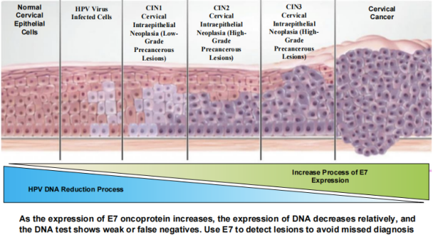 Diagram showing E7 Oncoprotein expressions and cervical cancer progression