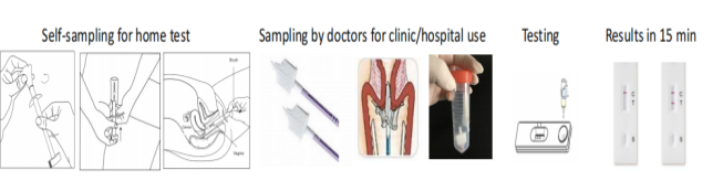 Step-by-step instructions for using HPV E7 Oncoprotein rapid test kit