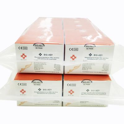 China Epstein Barr Virus EBV Real Time PCR Detection Kit Lyophilized 48tests/Kit for sale