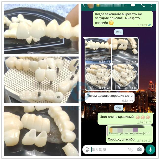 Dental restoration case study 3