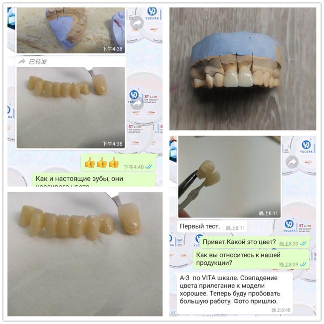 Dental restoration case study 4