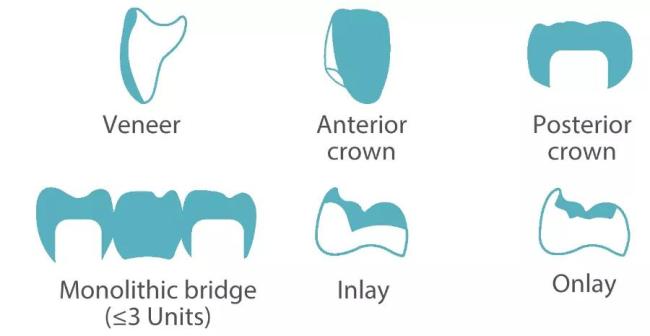 Dental bridge applications with YUCERA zirconia material