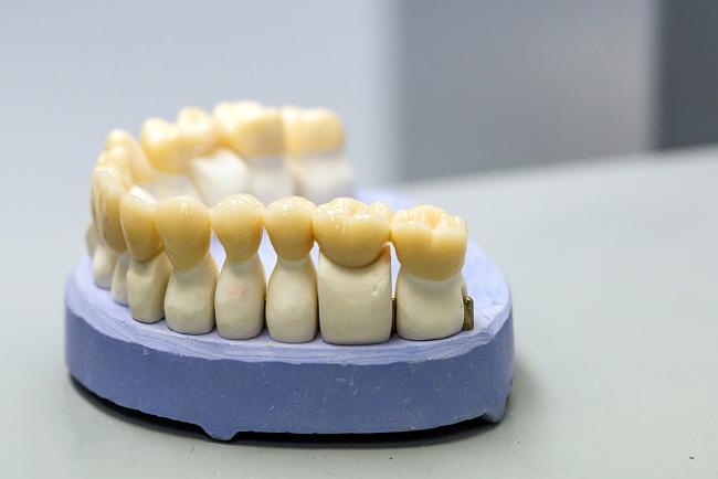 Professional dental lab feedback