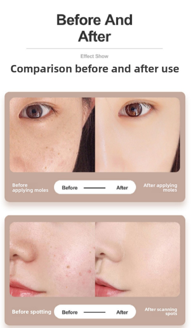 Rechargeable Nine-Speed ABS Dot Pen Handheld LED Indicator and USB Plug for Home Beauty Freckle Spot Removal