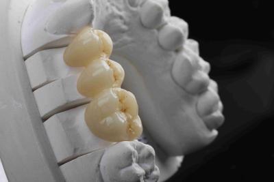 China 3D Multilayer Dental Zirconia Block Natural Gradient High Transmittance for sale