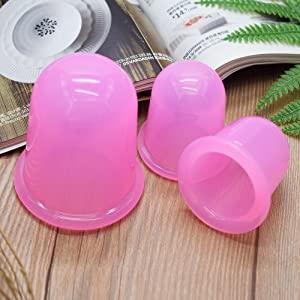 cupping therapy set