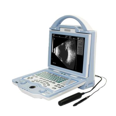 中国 High Resolution Dog Ultrasound Scanner LCD Screen Ophthalmic For Ophthalmolog 販売のため