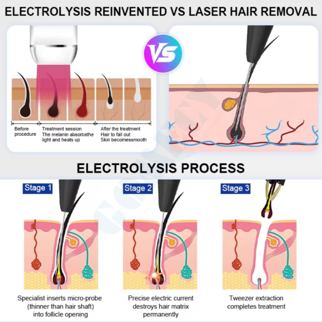 Professional RF High Frequency Vascular Removal Machine With Electrolysis Needle Hair Removal System