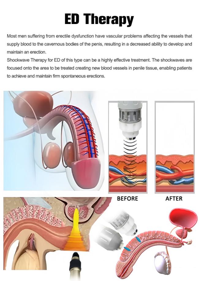 Physical Product pain relief body pain removal shockwave therapy