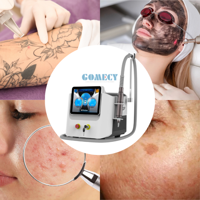 picolaser tattoo removal machine