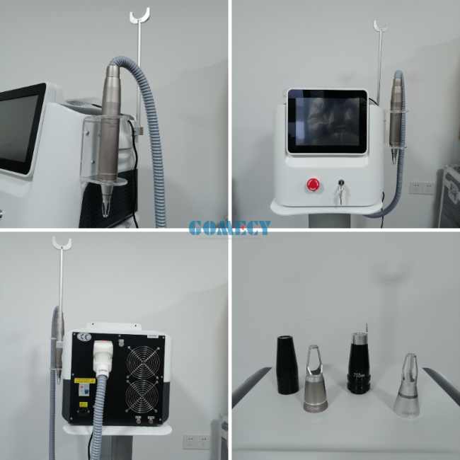 picolaser tattoo removal machine